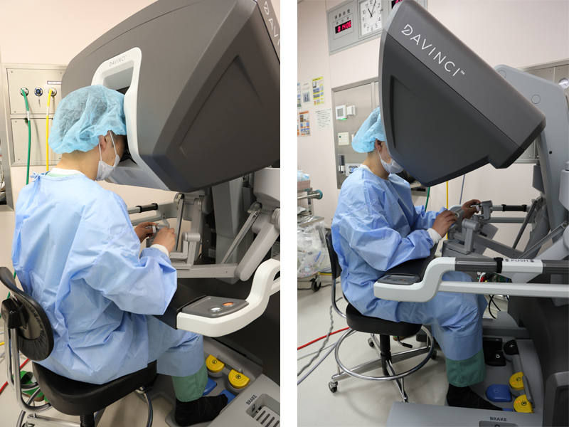 ロボット支援下大腸切除術