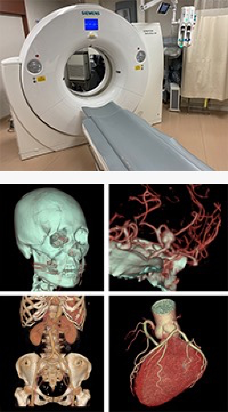 救急CT検査室